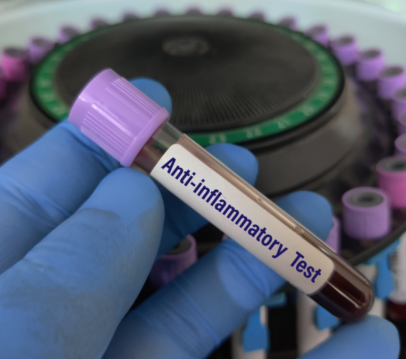 Anti-Inflammatory Nutritionist